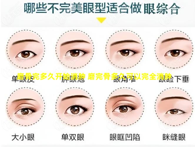 磨骨完多久开始消肿 磨完骨多久可以完全消肿
